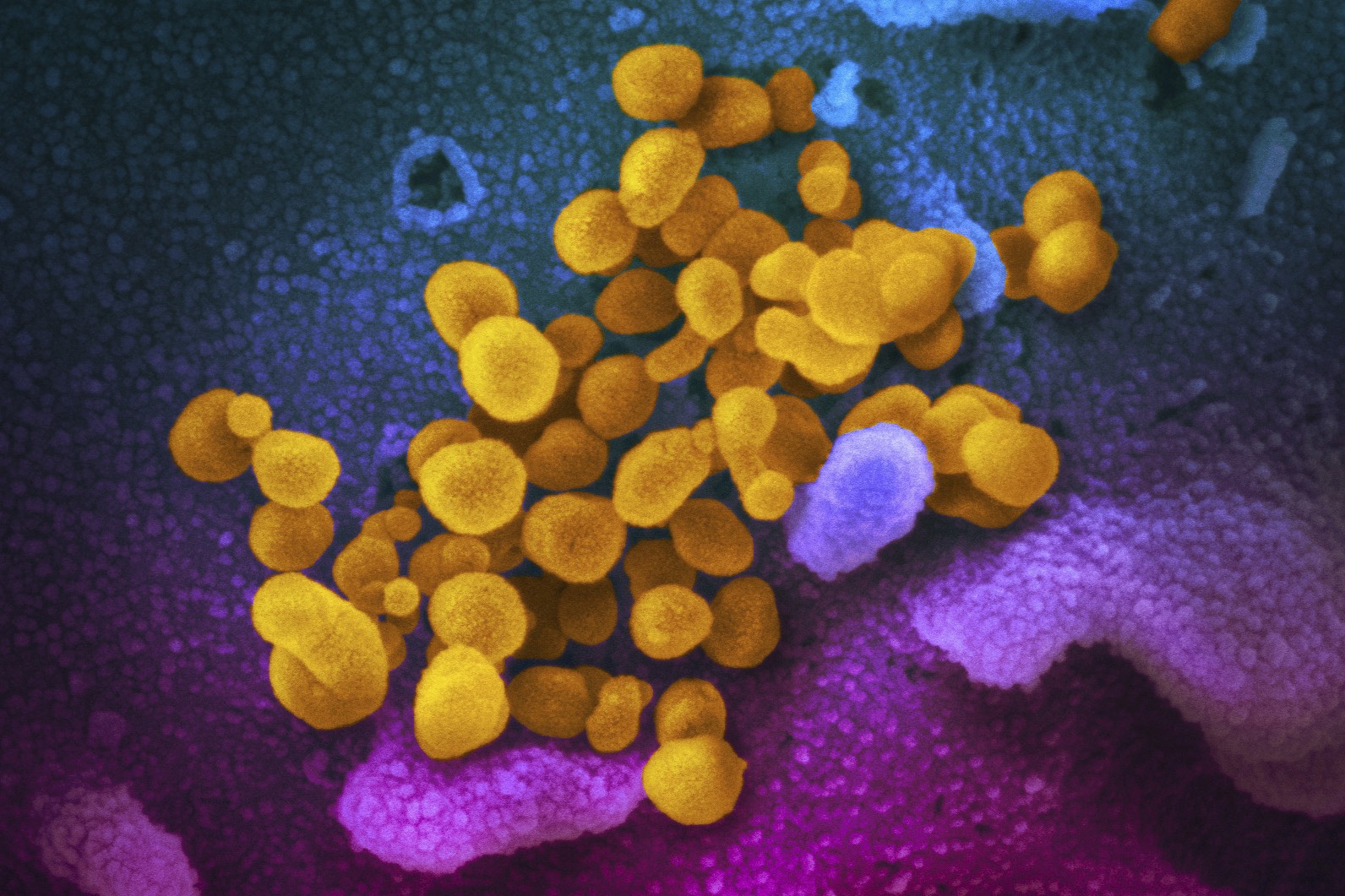 Coronavirus up close