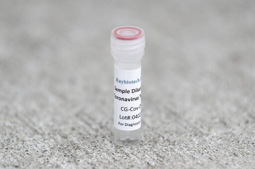 Antibody test