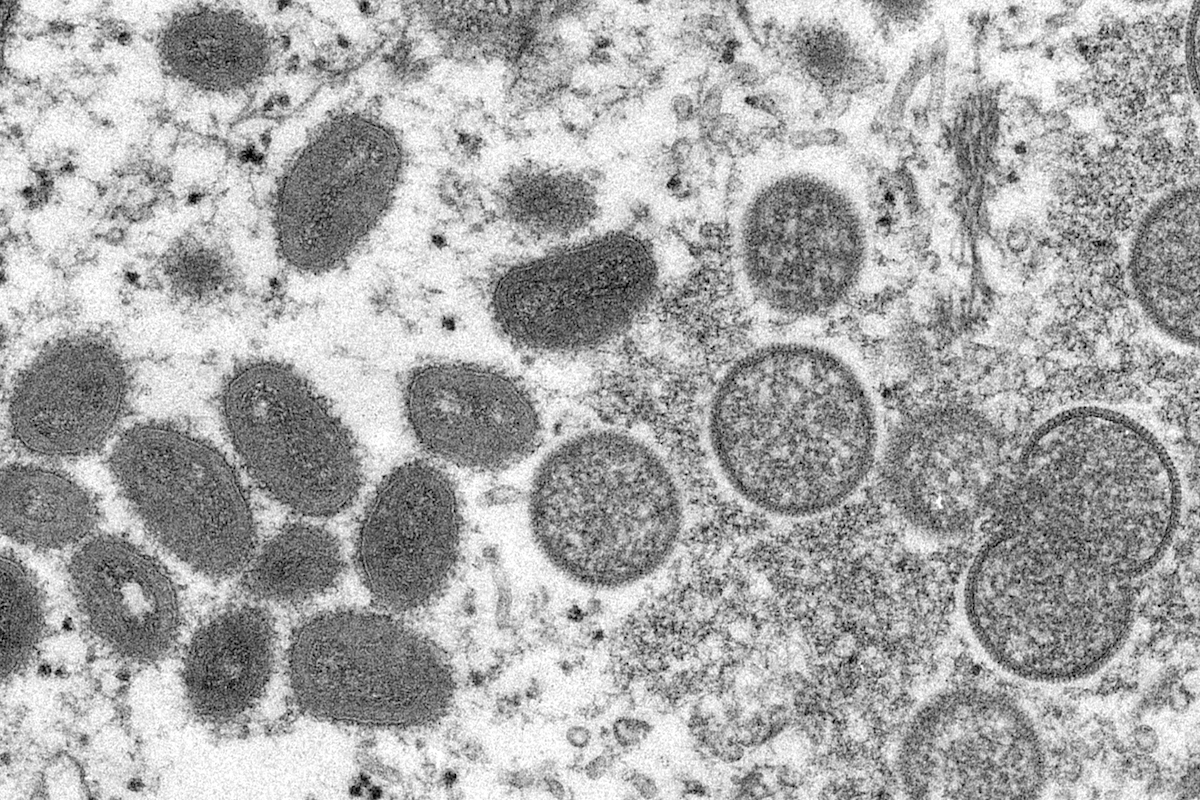 Monkeypox electron microscope image