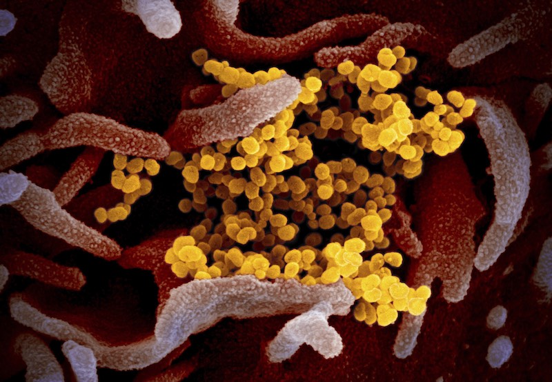 coronavirus molecule
