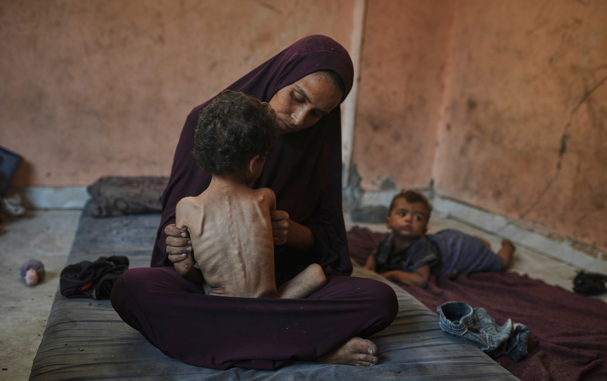 Gaza city mother with malnourished child 7/23/25