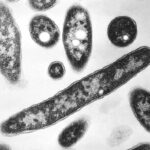 4 facts during a deadly NYC Legionnaires’ outbreak