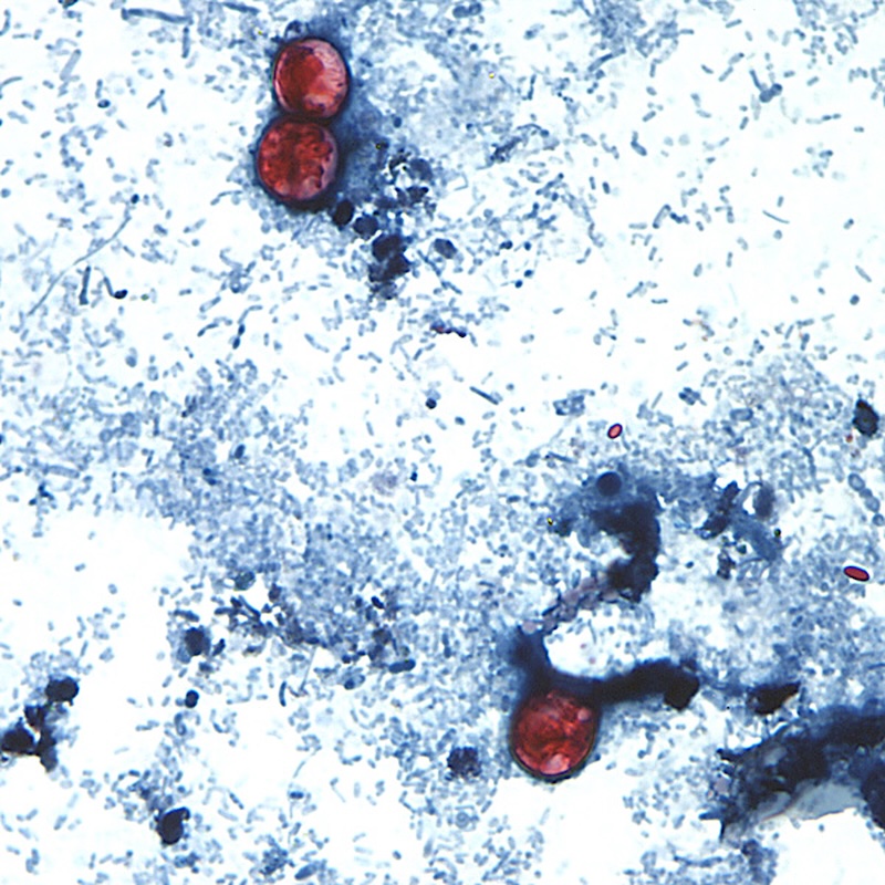Stool sample with cyclospora oocysts CDC